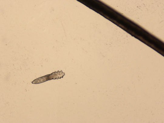 Demodex-Mites-4