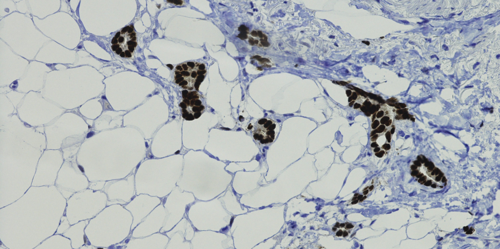 Pathology Reference Lab in San Antonio, Texas Precision Pathology